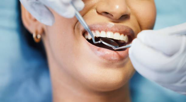 Best Same-Day Emergency Dentist in South Bloomfield, OH