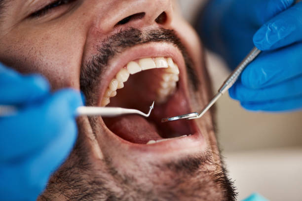 Best Emergency Treatment for Toothache in South Bloomfield, OH
